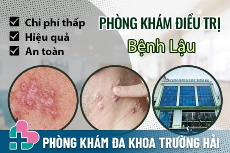 Địa chỉ chữa bệnh lậu ở Huyện Thanh Hà uy tín